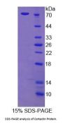 Rat Cortactin (CTTN) Protein