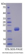 Rabbit Superoxide Dismutase 3 (SOD3) Protein