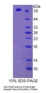 Rat Scavenger Receptor Class B Member 1 (SCARB1) Protein