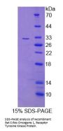 Rat Proto-Oncogene Tyrosine-Protein Kinase ROS (ROS1) Protein