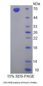 Rat Mucin 1 (MUC1) Protein