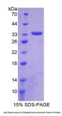 Rat Platelet Derived Growth Factor D (PDGFD) Protein