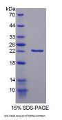 Rat Cyclin Dependent Kinase Inhibitor 1A (CDKN1A) Protein