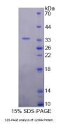 Rat Interleukin 20 Receptor Alpha (IL20Ra) Protein