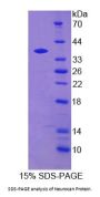 Rat Neurocan (NCAN) Protein