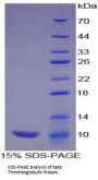 Rat Beta-Thromboglobulin (bTG) Protein