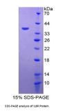 Rat Interleukin 6 Receptor (IL6R) Protein