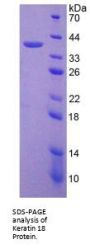 Rat Keratin 18 (KRT18) Protein