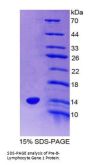 Rat Pre-B-Lymphocyte Gene 1 (VPREB1) Protein