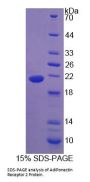 Rat AdiPonectin Receptor 2 (ADIPoR2) Protein