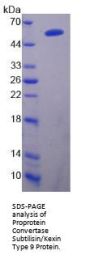 Rat Proprotein Convertase Subtilisin/Kexin Type 9 (PCSK9) Protein