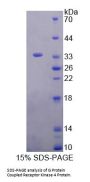 Human G Protein Coupled Receptor Kinase 4 (GRK4) Protein