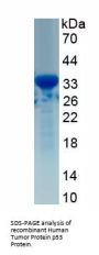 Human Cellular Tumor Antigen P53 (TP53) Protein