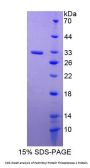 Mouse Palmitoyl Protein Thioesterase 1 (PPT1) Protein