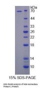 Human NK6 Homeobox Protein 1 (NKX6-1) Protein