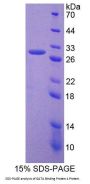 Human GATA Binding Protein 4 (GATA4) Protein