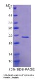 Human Visinin Like Protein 1 (VSNL1) Protein