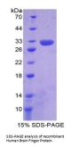 Human Ring Finger Protein 112 (RNF112) Protein