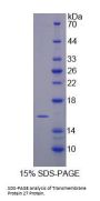 Mouse Transmembrane Protein 27 (TMEM27) Protein