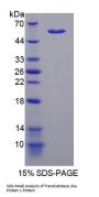 Human Transketolase Like Protein 1 (TKTL1) Protein