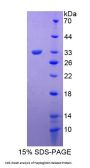 Human Haptoglobin Related Protein (HPR) Protein