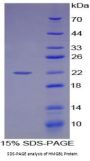 Human High Mobility Group Protein B1 (HMGB1) Protein