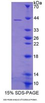 Human S100 Calcium Binding Protein A14 (S100A14) Protein