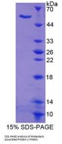 Mouse Metastasis Associated Protein 1 (MTA1) Protein