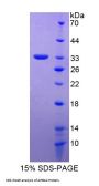Human Amyloid Beta Precursor Protein Binding Protein A2 (APBA2) Protein