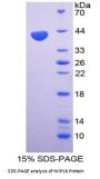 Human Macrophage Inflammatory Protein 1 Beta (MIP1b) Protein