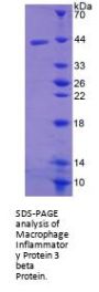 Mouse C-C Motif Chemokine 19 (CCL19) Protein