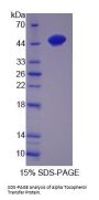 Mouse Alpha-Tocopherol Transfer Protein (TTPA) Protein