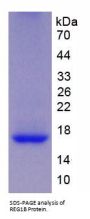 Human Regenerating Islet Derived Protein 1 Beta (REG1b) Protein