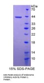 Rat Melanoma-Derived Growth Regulatory Protein (MIA) Protein