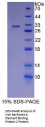Human Iron ResPonsive Element Binding Protein 2 (IREB2) Protein