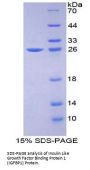 Human Insulin Like Growth Factor Binding Protein 1 (IGFBP1) Protein