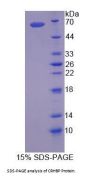 Rat Corticotropin Releasing Hormone Binding Protein (CRHBP) Protein