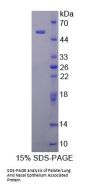 Human BPI Fold-Containing Family A Member 1 / PLUNC (BPIFA1) Protein
