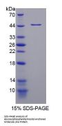 Human Glycosylphosphatidylinositol Anchored Molecule Like Protein (GML) Protein