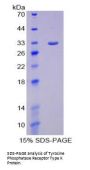 Human Protein Tyrosine Phosphatase Receptor Type K (PTPRK) Protein