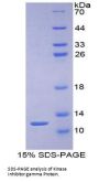 Human Protein Kinase Inhibitor Gamma (PKIg) Protein