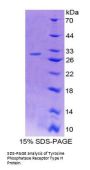 Mouse Protein Tyrosine Phosphatase Receptor Type H (PTPRH) Protein