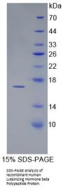 Human Luteinizing Hormone Beta Polypeptide (LHb) Protein