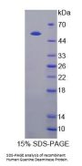 Human Guanine Deaminase (GDA) Protein
