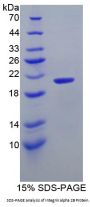 Human Integrin Alpha IIb / CD41 (ITGA2B) Protein