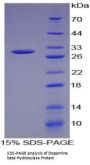 Human Dopamine Beta Hydroxylase (DbH) Protein