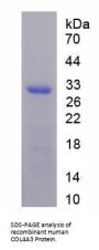 Human Collagen Type IV Alpha 3 (COL4A3) Protein