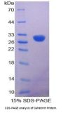 Human Calretinin (CALB2) Protein