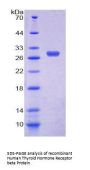 Human Thyroid Hormone Receptor Beta (THRb) Protein