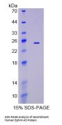 Human Ephrin A5 (EFNA5) Protein